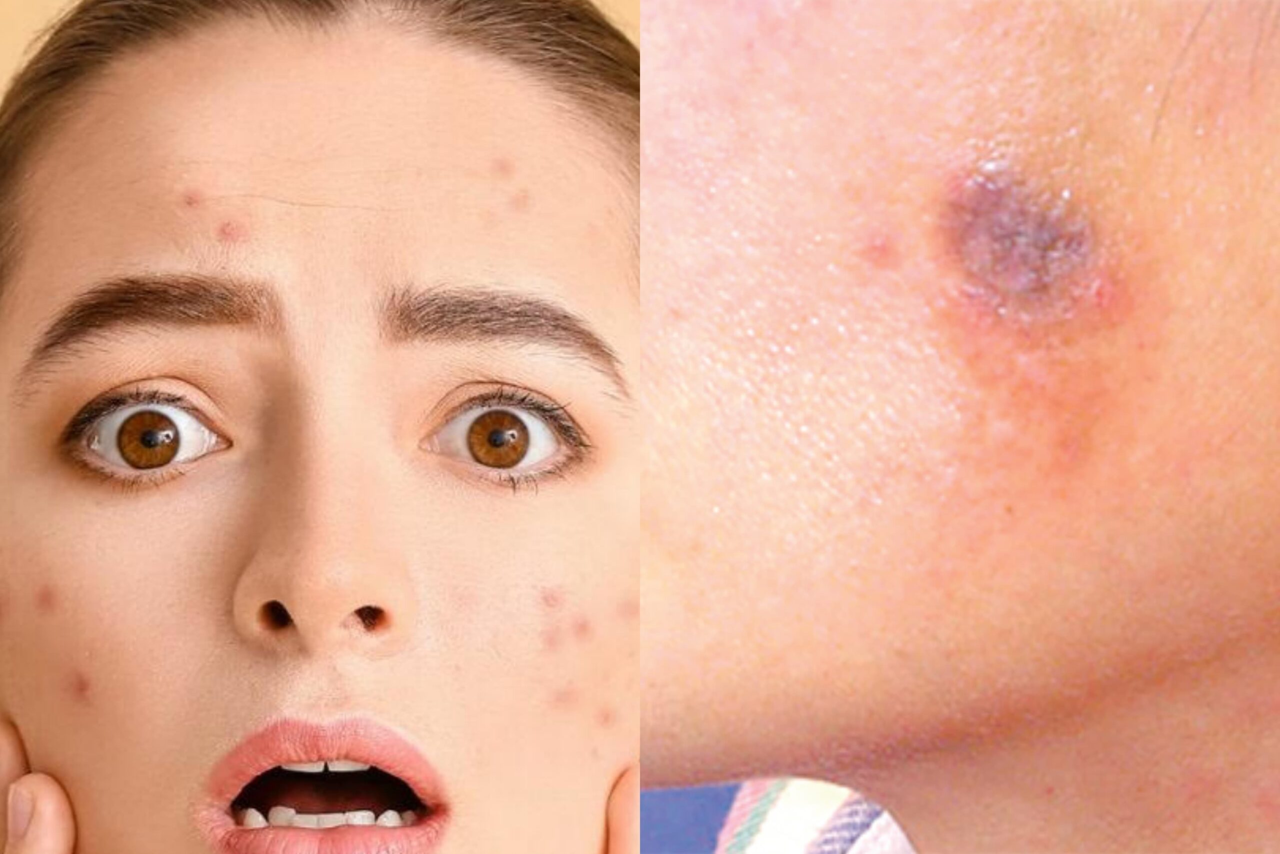 සිරුරේ කළු ලප භයානක රෝගයක පෙරනිමිත්තක් කියලා ඔයත් දැනගෙන සිටියාද ?